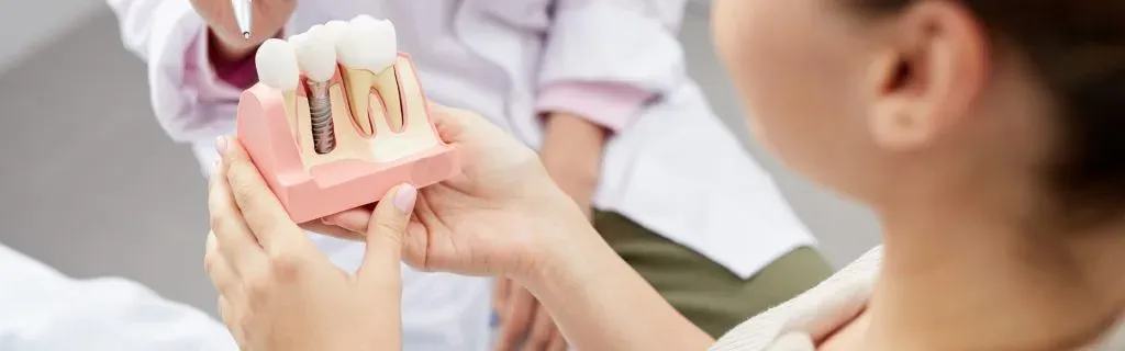 Living with zygomatic implants 1 1024x320
